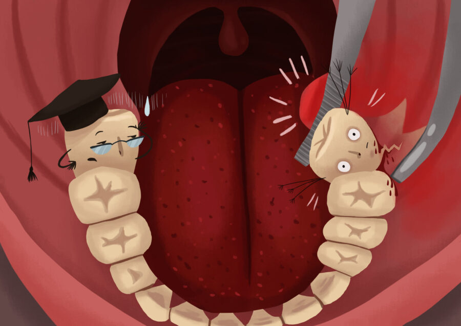 Illustration of wisdom teeth (teeth with glasses and graduation hats that make them look wise) being removed from a mouth
